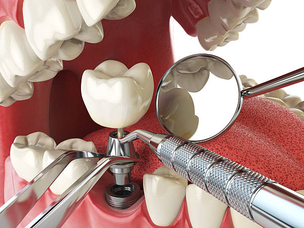 Best Emergency Treatment for Jaw Pain or Injury in Greybull, WY